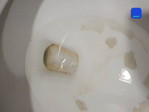 단원구 · 통화 상담 이용 고객 글 사진